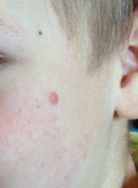 Red spot (but not a spot) - photo included