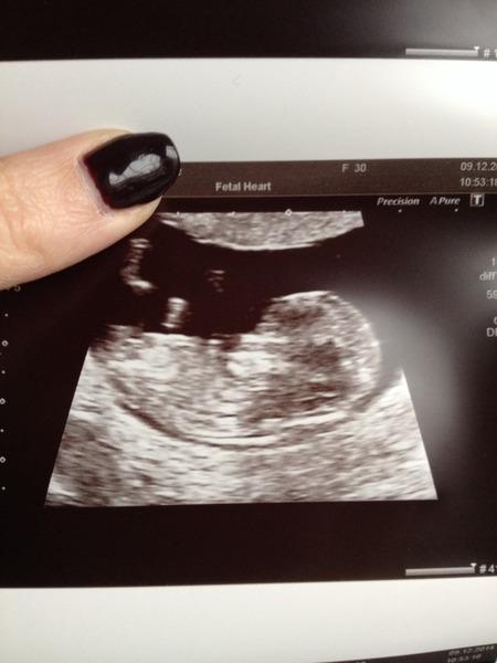 Guess the gender from scan pic? I know it's asked all the time but I'm just too excited!