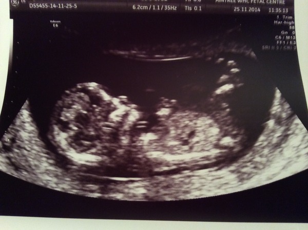 June 2015 - thread 5 - second trimester fast approaching