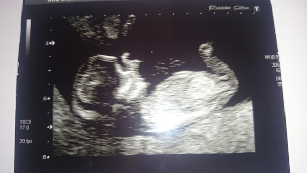 June 2015 - thread 5 - second trimester fast approaching