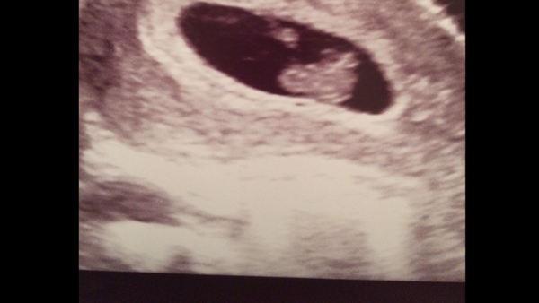 July thread - we are nearing the end of the first trimester, announcements will be made soon!