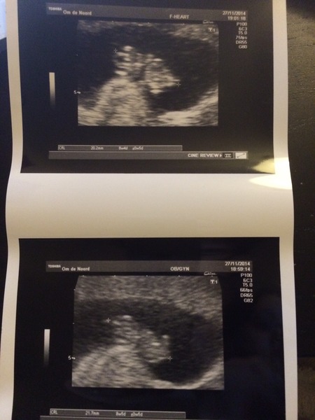 July Thread 3 - I can't KEEP CALM, I'm Pregnant! The one where the hormones start to kick in...