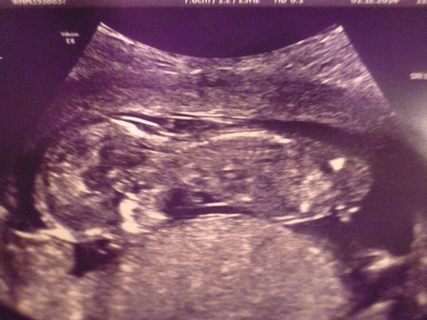 June 2015 - thread 5 - second trimester fast approaching