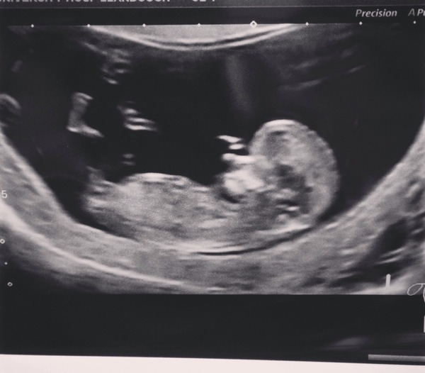 Huge uterus?!!!!