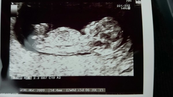 July thread - we are nearing the end of the first trimester, announcements will be made soon!