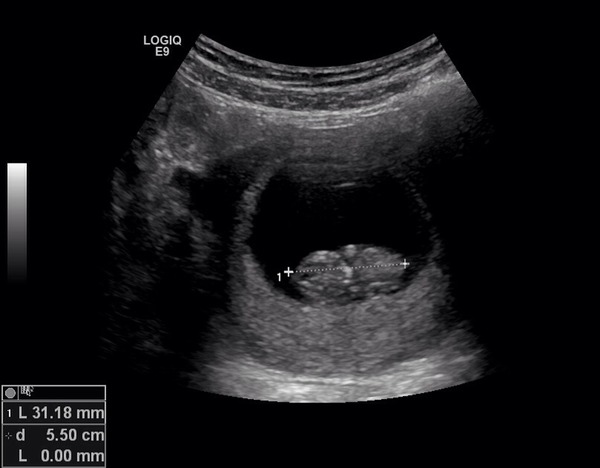 July thread - we are nearing the end of the first trimester, announcements will be made soon!