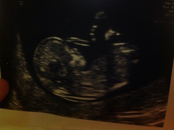 Anyone fancy guessing the sex? Scan tomorrow!