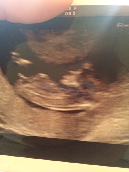 June 2015 - thread 5 - second trimester fast approaching