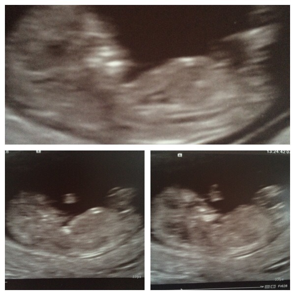 Yet another guess the gender thread!