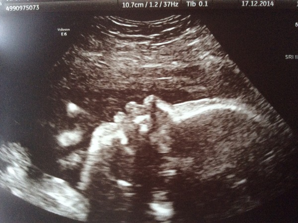 Feb 15, Number 6- Third trimester is ON!