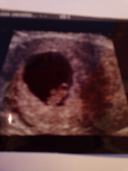 Scan...so scared