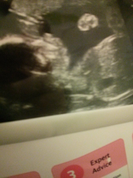 April 2015 thread 6: our Christmas puddings are half cooked, now bring on the glow!