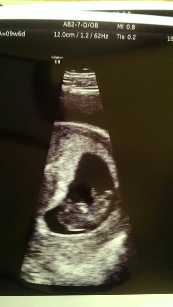 July thread - we are nearing the end of the first trimester, announcements will be made soon!