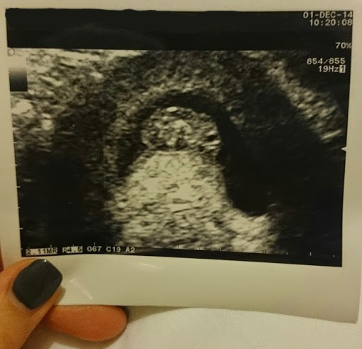 July Thread 3 - I can't KEEP CALM, I'm Pregnant! The one where the hormones start to kick in...