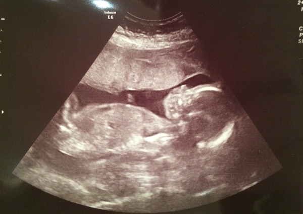 April TTC girls! Where there's a new baby! Tons of BFP's! And lots more to come!