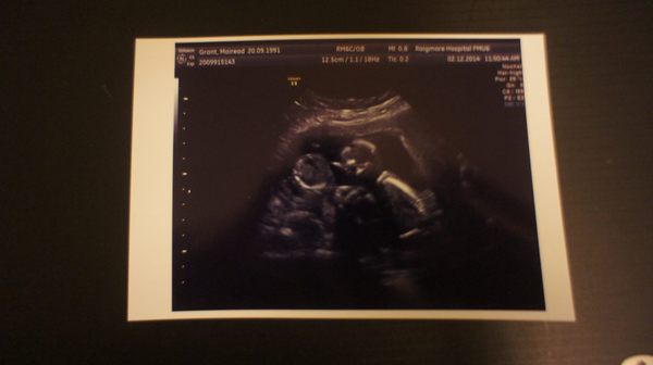 June 2015 - thread 5 - second trimester fast approaching