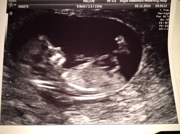 Old bird graduates, gather round....let's talk chicklets!