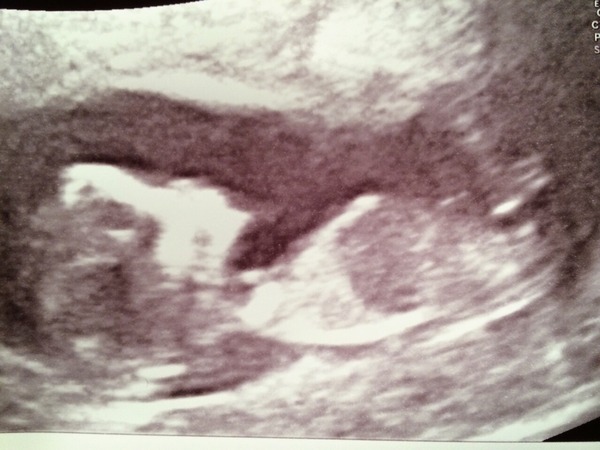 June 2015 - thread 5 - second trimester fast approaching