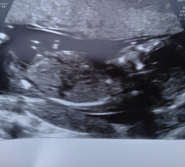 Guessing the gender