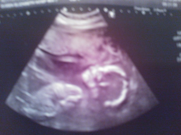 May 2015 - thread 4 - the one where it all gets real!