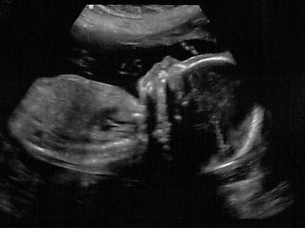 April 2015 thread 6: our Christmas puddings are half cooked, now bring on the glow!