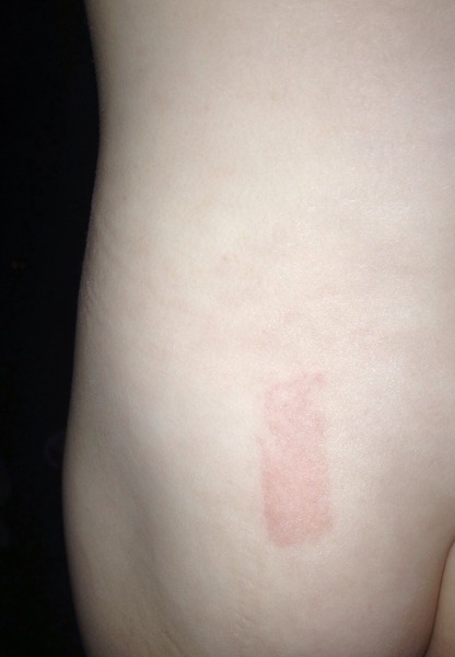 Advice please? What is this?