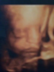 March Mummies 2015 - second tri continues with ever growing bumps, boobs and babies