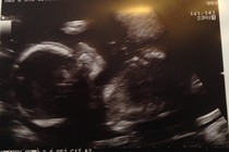 April 2015 thread 6: our Christmas puddings are half cooked, now bring on the glow!