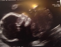 April 2015 thread 6: our Christmas puddings are half cooked, now bring on the glow!