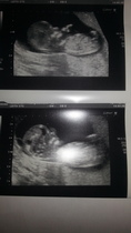 whos good at guessing gender by scan?