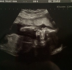 April 2015 thread 6: our Christmas puddings are half cooked, now bring on the glow!