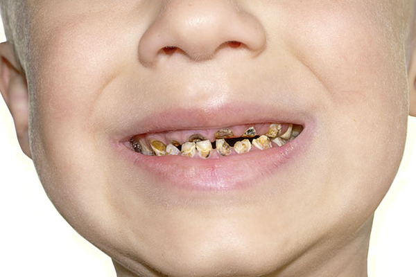 Cleaning 1yo teeth.