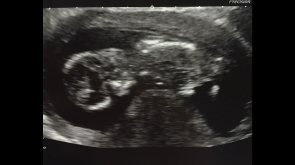 July '15 - starting our 2nd trimester