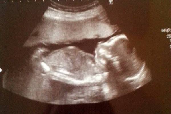 June 2015 - thread 7 - finding out our teams!! Pink/Blue/Yellow which are you?