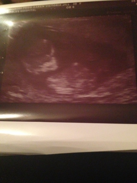 4D/ gender scan on Tuesday - so excited! Guesses in meantime?