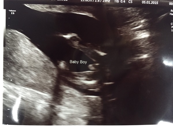 Confused about the gender scan