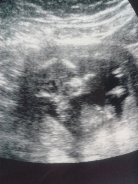 any gender guesses please?