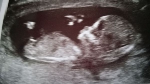 July '15 - starting our 2nd trimester