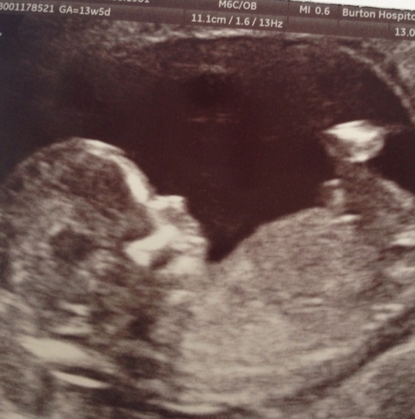 boy or girl