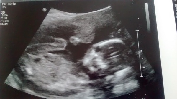 June 2015 - thread 7 - finding out our teams!! Pink/Blue/Yellow which are you?