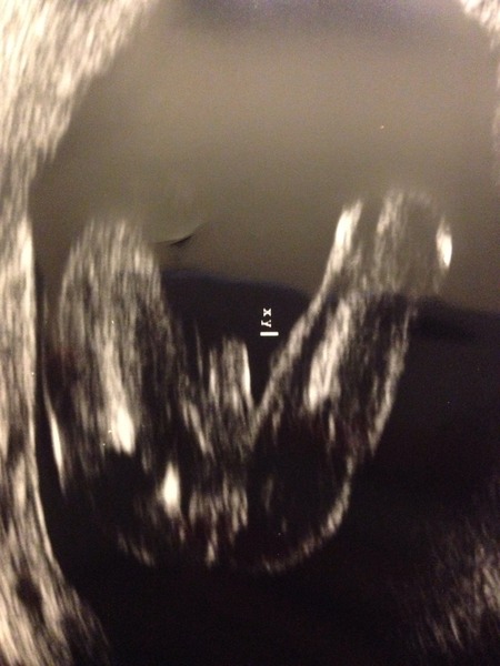 Confused about the gender scan