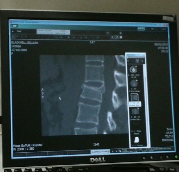 D'ya ever wonder if you could still do the twist and not actually wet yourself in the process?