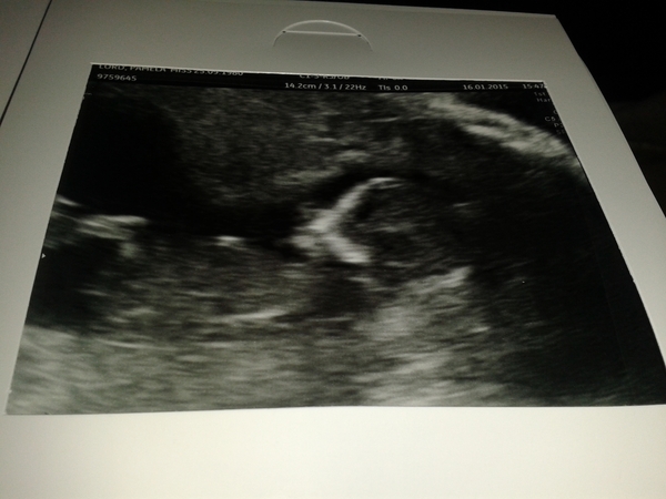 July '15 - starting our 2nd trimester