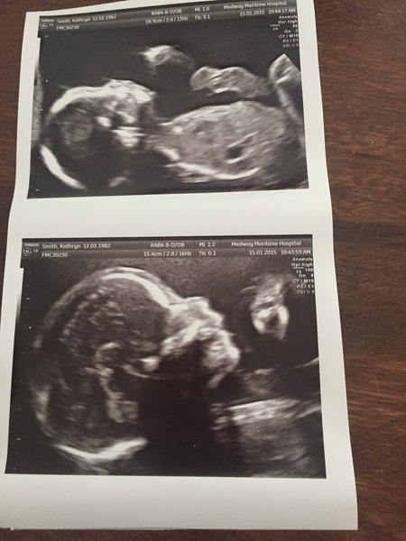 May 2015 - thread 5 - yellow, pink or blue, which team are you?