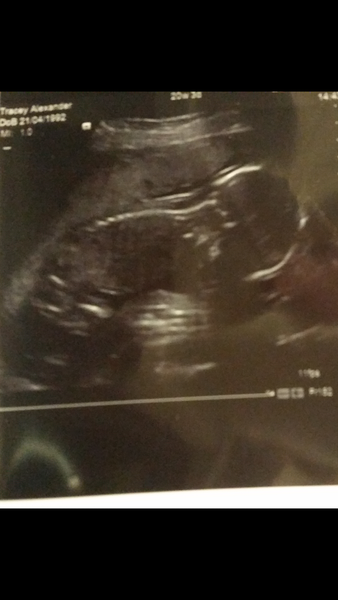 June 2015 - bumps ahoy!