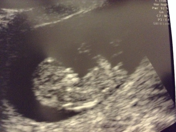 Gender prediction by 12 week scan!