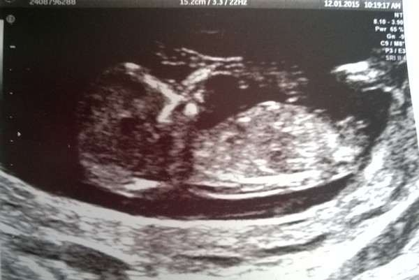 boy or girl