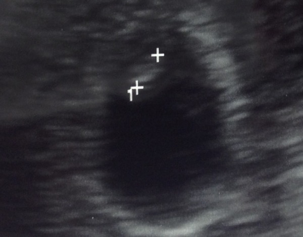 September 2015 (#3) bring on the scans as our waists expand!