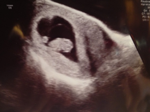 September 2015 (#3) bring on the scans as our waists expand!