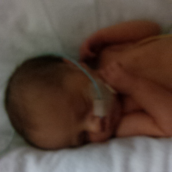 Jaundice newborn or mixed race?